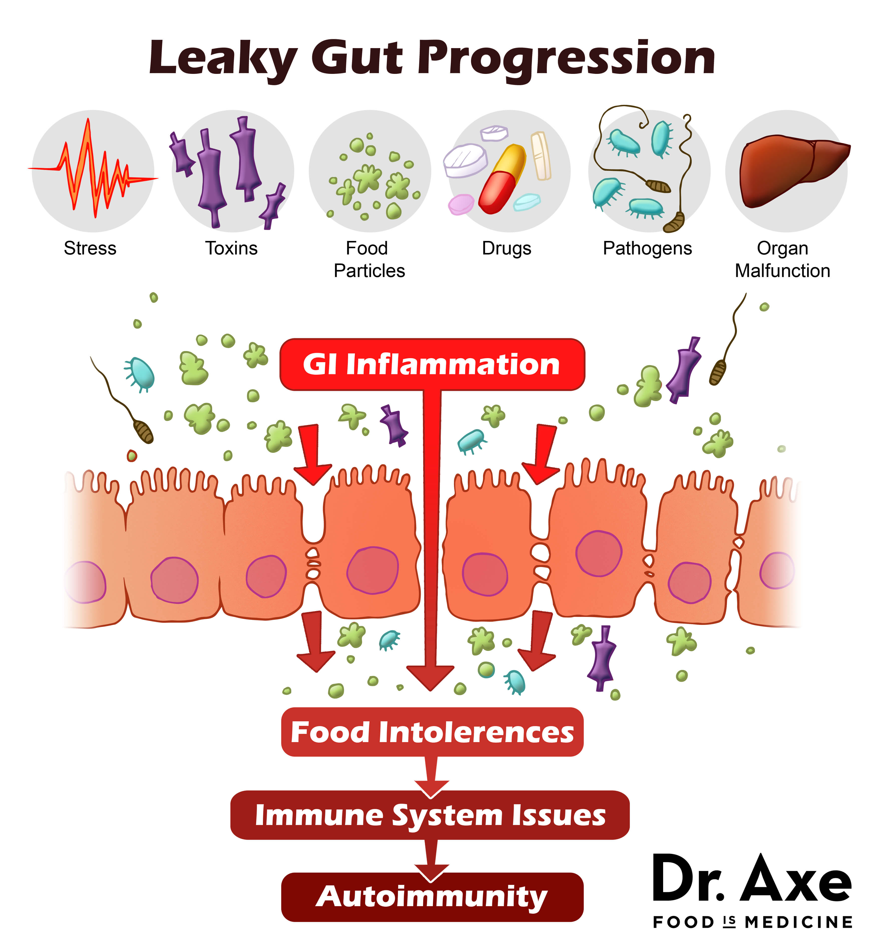 leaky gut progression chart
