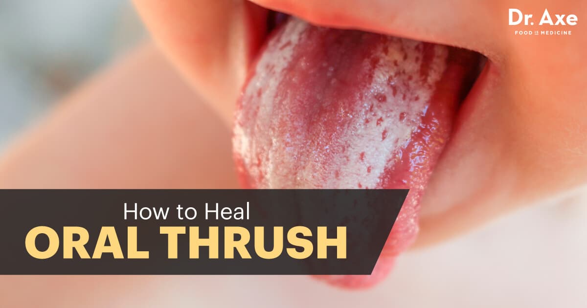 18 Natural Ways To Heal Oral Thrush Dr Axe