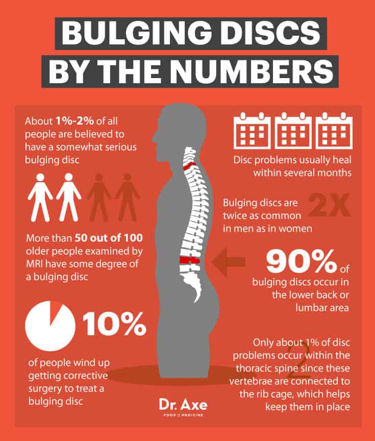 What Is A Bulging Disc In The Lower Back