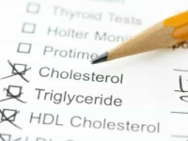 Image result for Low cholesterol levels will promote aging