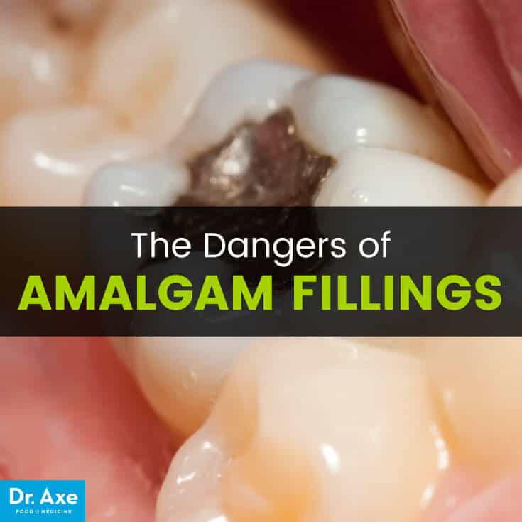 Amalgam fillings - Dr. Axe