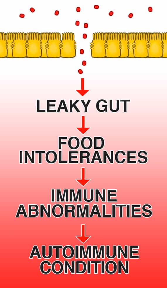 Guide-To-Healing-Autoimmune-Disease-And-Leaky-Gut 