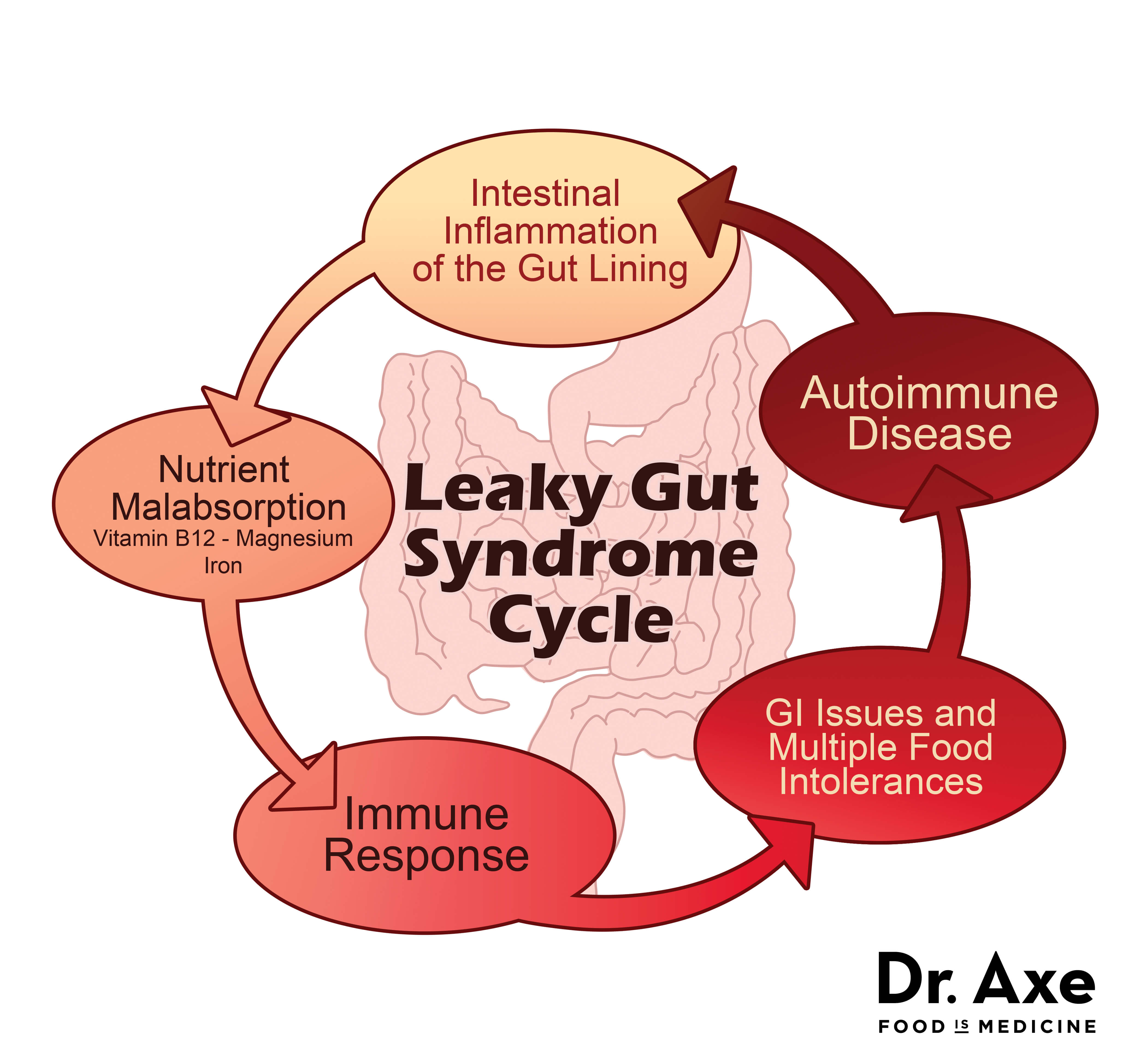 leaky gut cycle chart