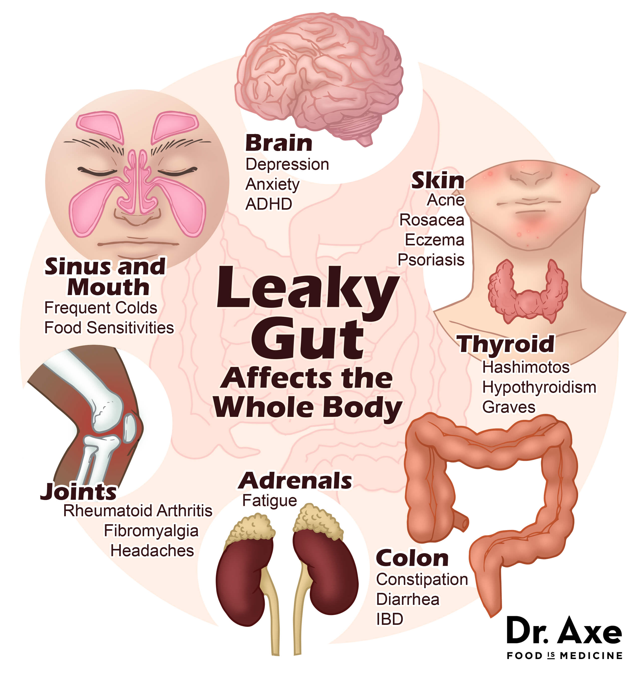 leaky gut syndrome symptoms diagram