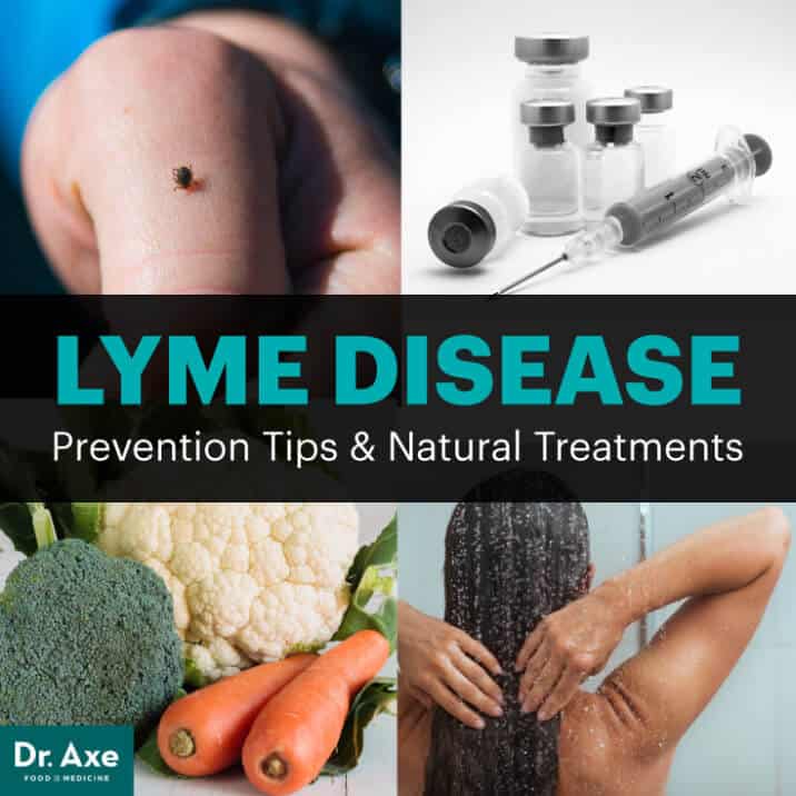 Lyme Disease Treatment Options, Causes, How To Prevent - Dr. Axe