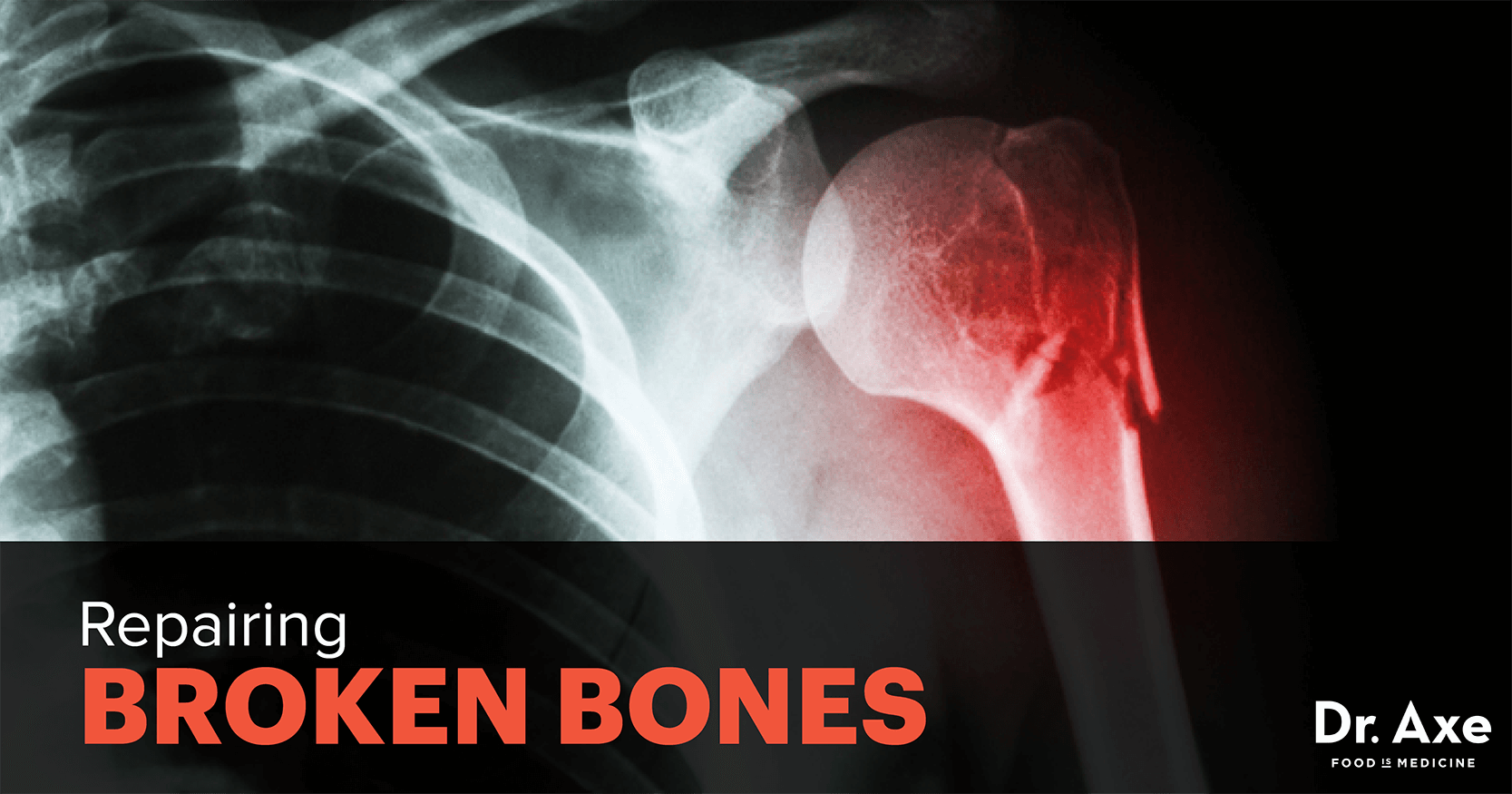 How To Heal Broken Bones Fast Dr Axe