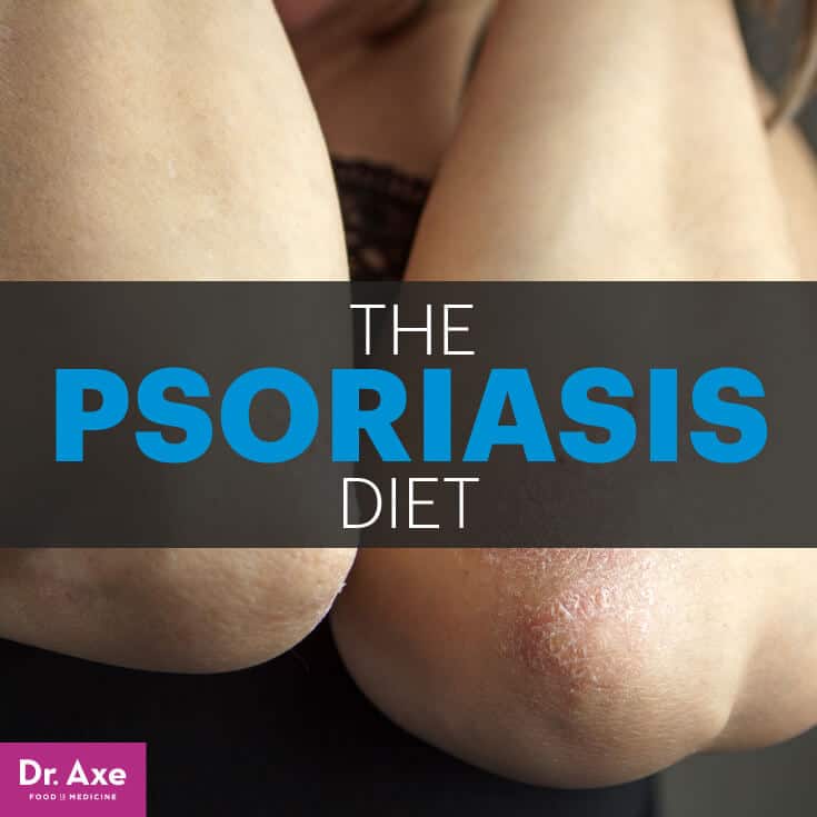 Psoriasis diet - Dr. Axe