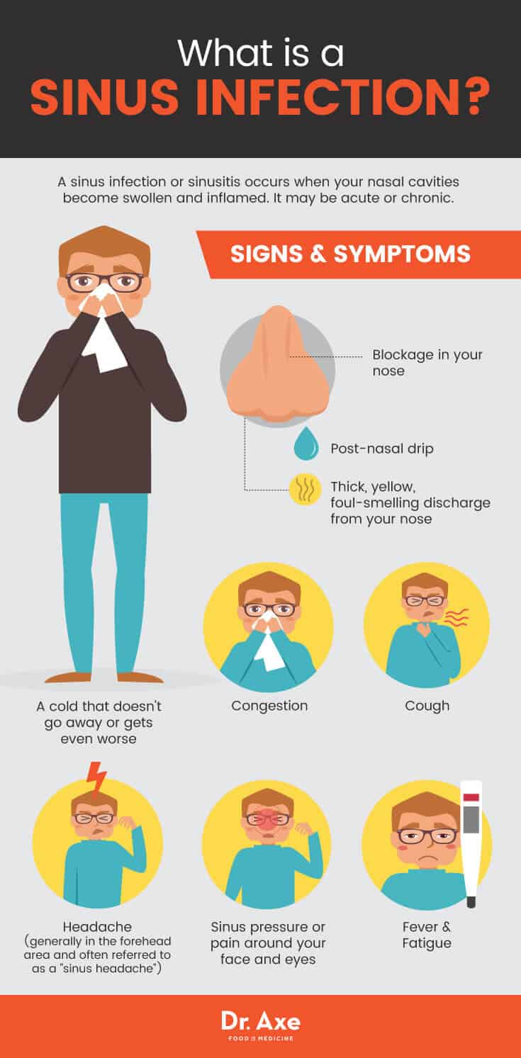 Sinusitis (Sinus Infection) - Symptoms & Causes