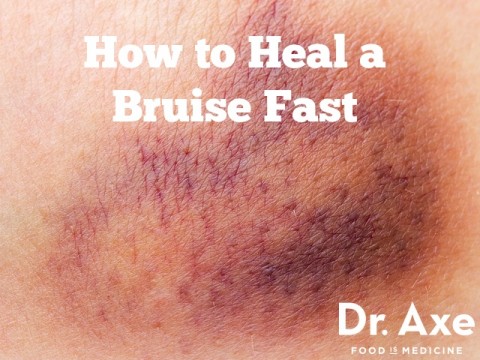 How do you make a bruise go away?