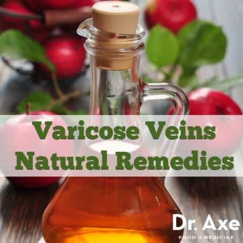 5 Varicose Veins Home Remedies - DrAxe.com