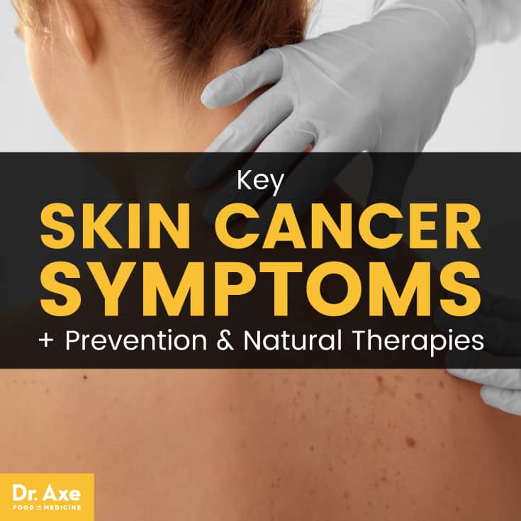 Skin cancer symptoms - Dr. Axe