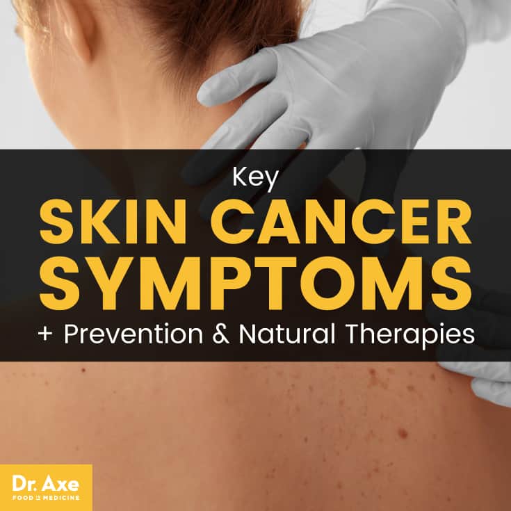 skin cancer symptoms