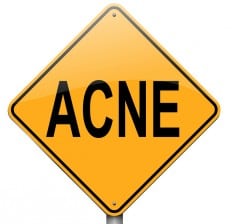 Acne Road caution Sign