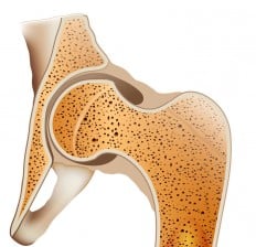 Hip joint, strong dense bones cross section 