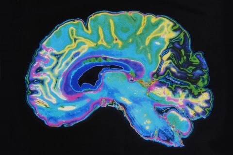 Brain MRI cross section