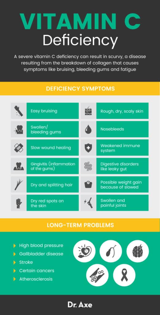 Vitamin C Foods, Signs of Deficiency & Health Benefits - Dr. Axe