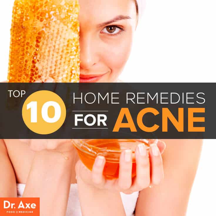 10 Home Remedies for Acne That Work - Dr. Axe
