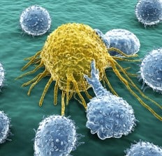 Cancer cell attacked by lymphocytes