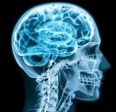 X-ray skull, MRI Brain
