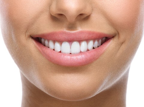 white teeth, woman's smile
