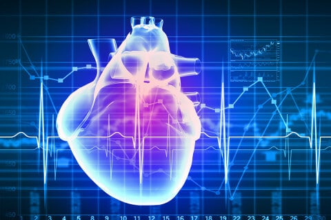 cardiogram