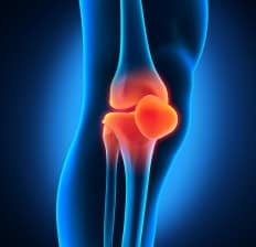 Painful Knee inflamation, joint arthritis pain