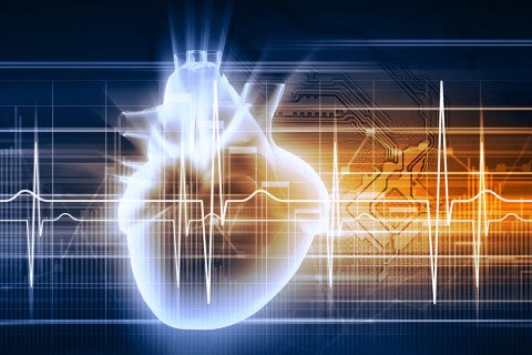 cardiogram