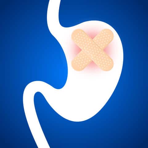 Gastritis