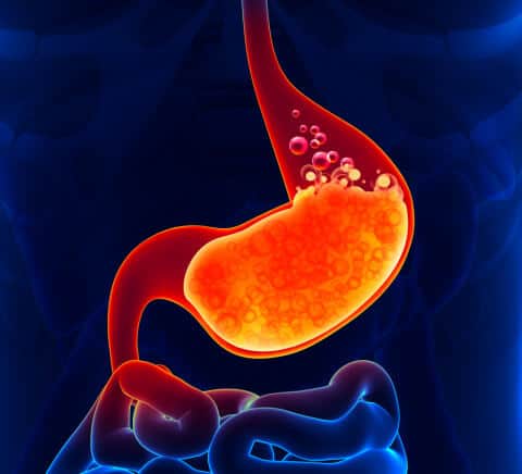 upset stomach, Indigestion and acid reflux illustration 