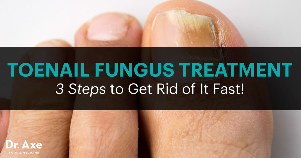 Toenail Fungus Treatment: 3 Steps to Get Rid of It Fast! - Dr. Axe