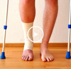 Bone healing - Dr. Axe