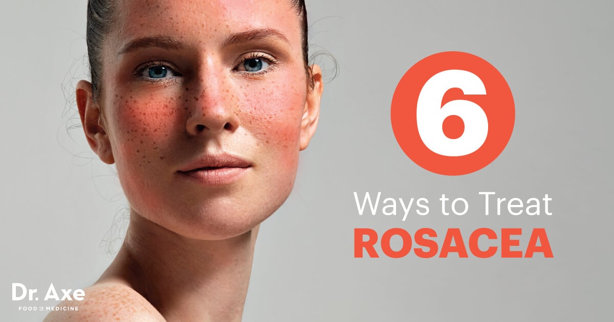 Natural Rosacea Treatment How to Treat Rosacea with Natural Home Remedies and Diet Modifications