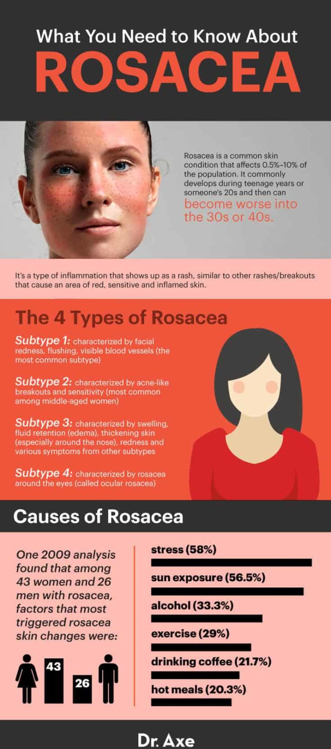 Rosacea Treatment 6 Natural Remedies to Use Dr. Axe