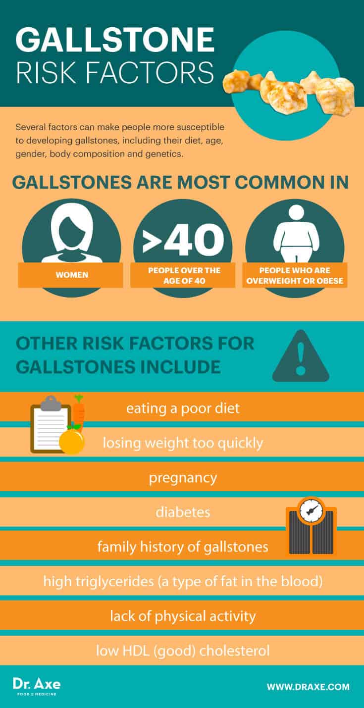 gallstones in women