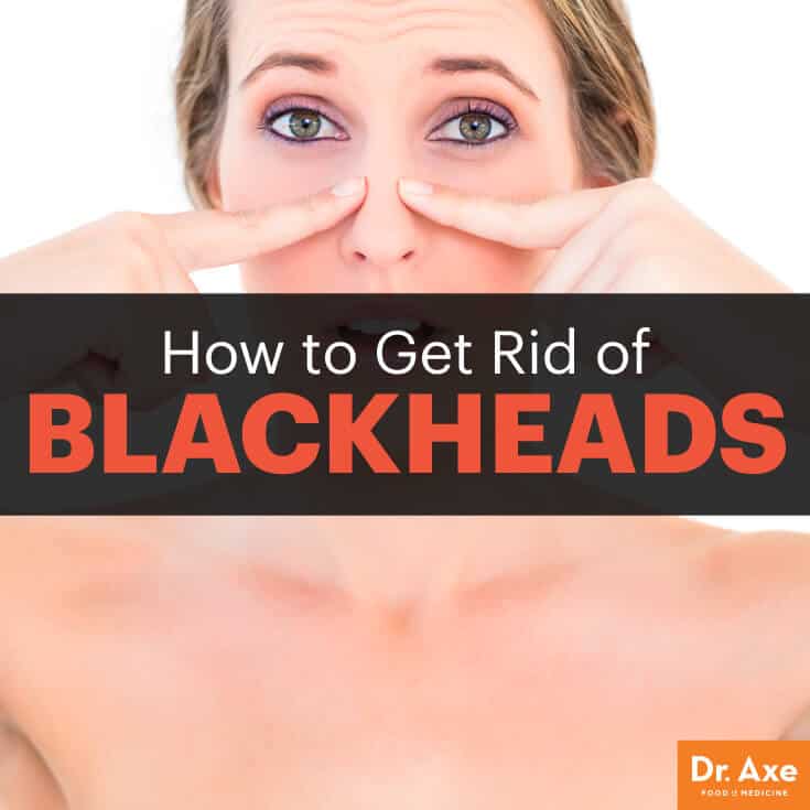 How To Get Rid Of Blackheads Dr Axe