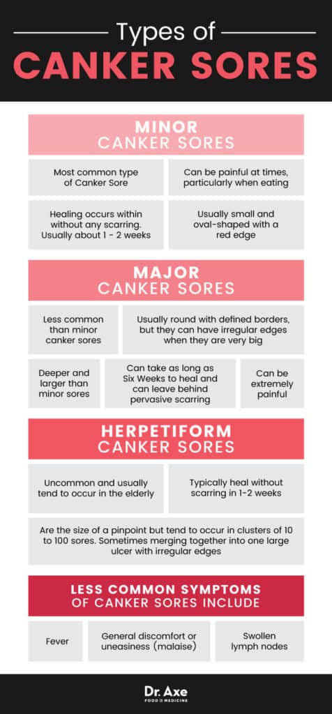 Canker Sore: Symptoms, Types + Natural Remedies - Dr. Axe