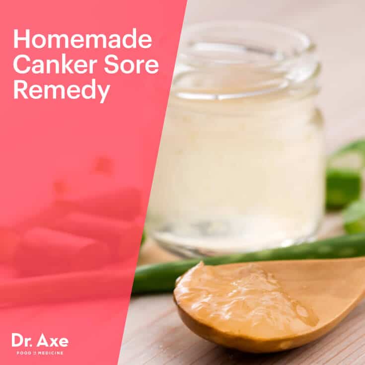 canker sore treatment