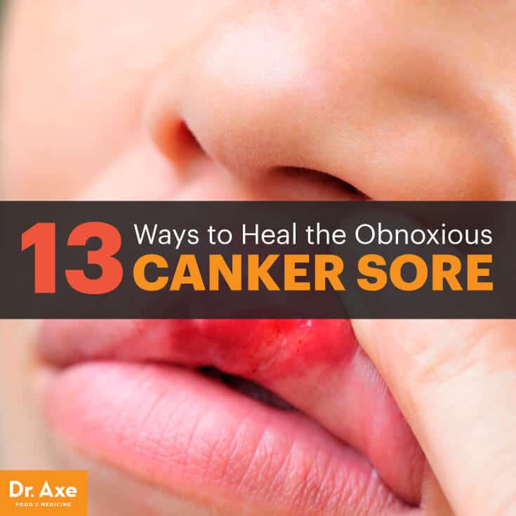 What is a cure for a canker sore?