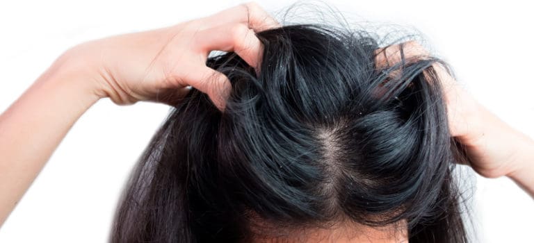 How to Get Rid of Dandruff: 10 Natural Remedies - Dr. Axe