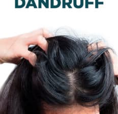 How to get rid of dandruff - Dr. Axe