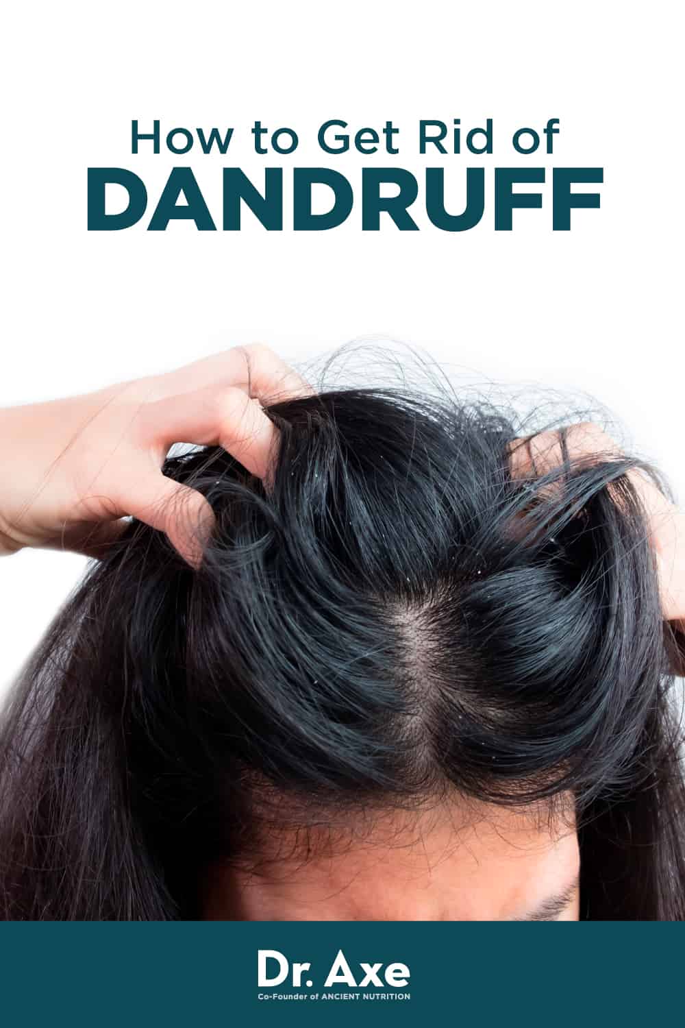 what can i do to get rid of dandruff naturally