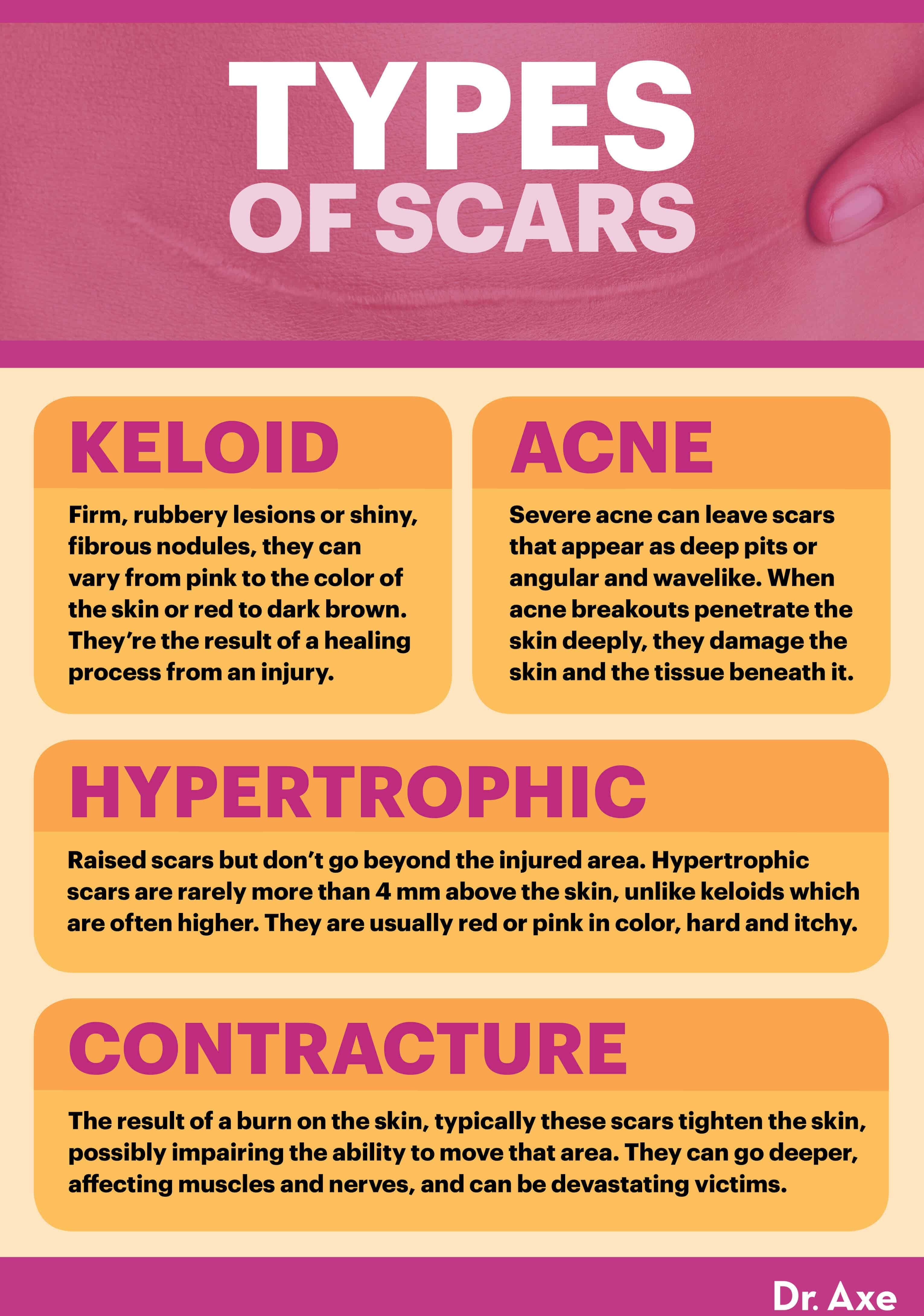 Types of scars - Dr. Axe