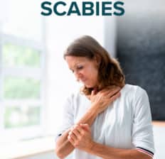 Scabies - Dr. Axe