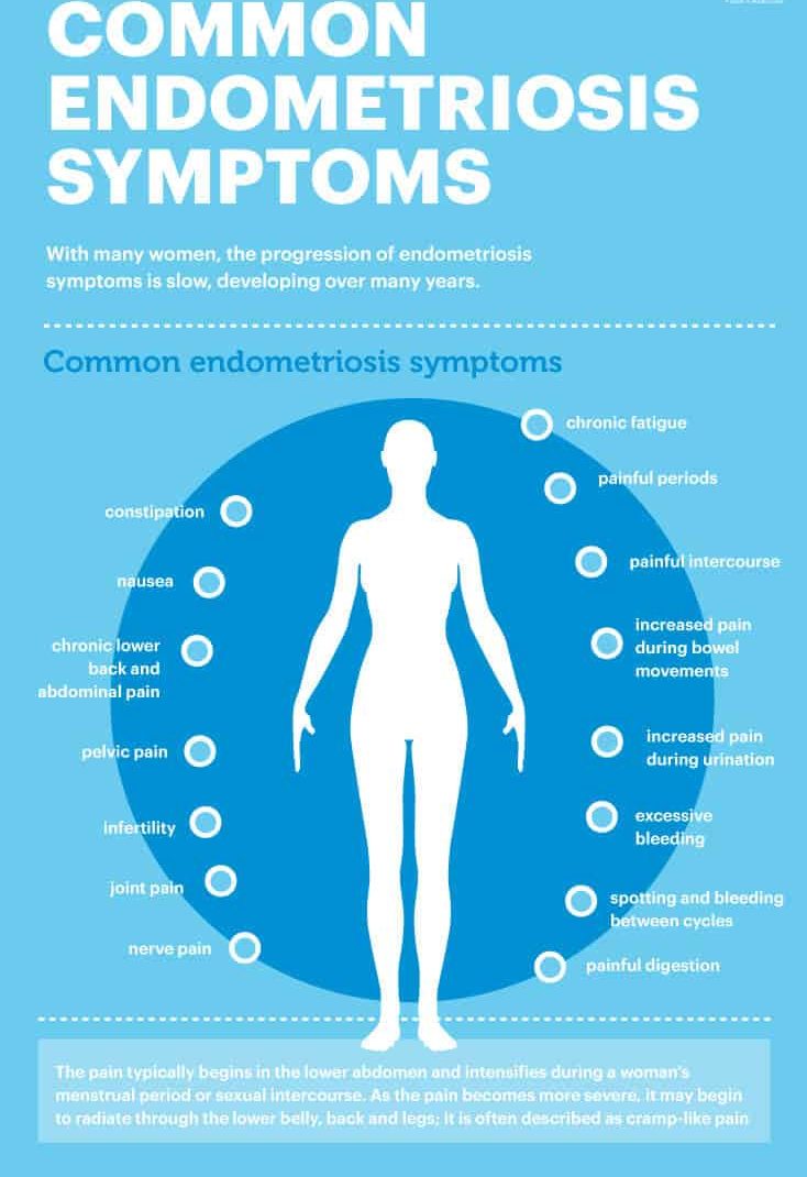 Sharecare on X: Could you spot the signs of endometriosis