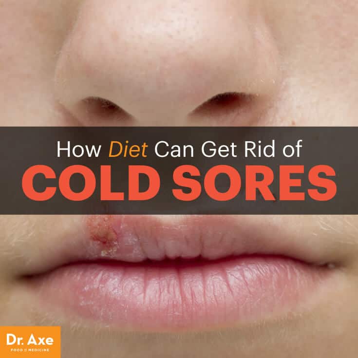 Cold sores - Dr. Axe