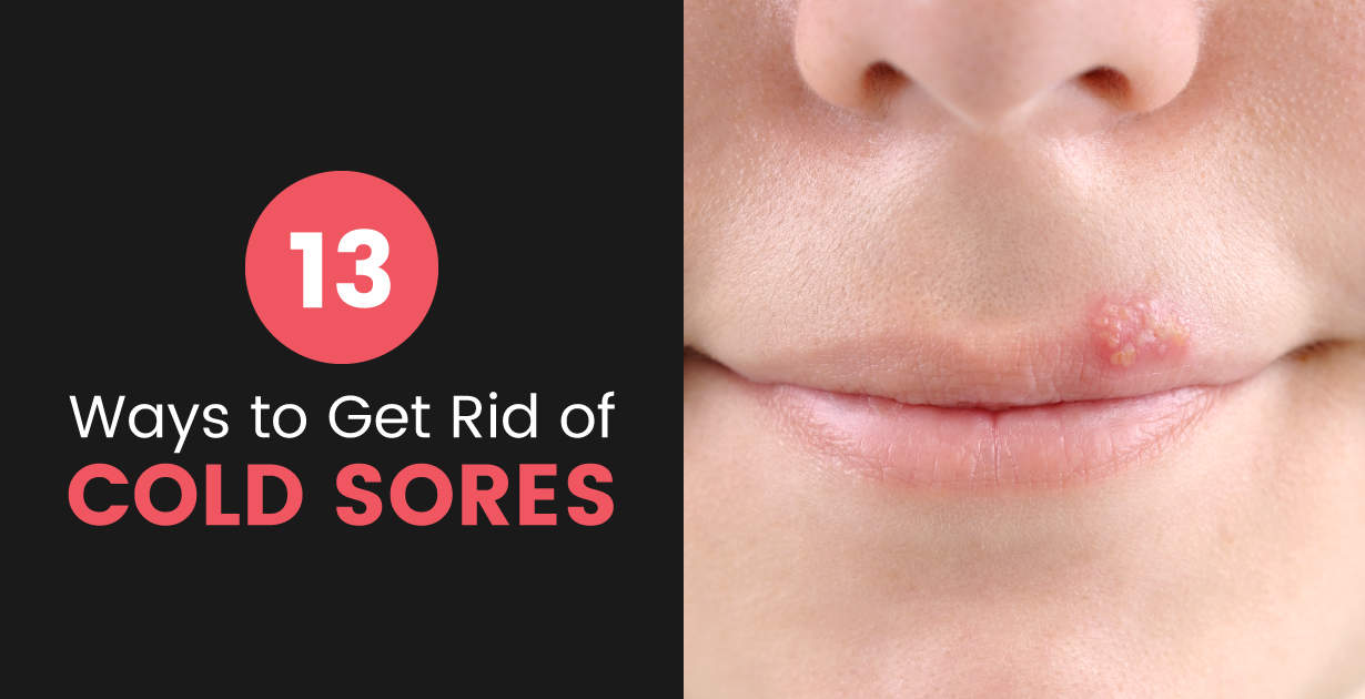 cold sores cool compress