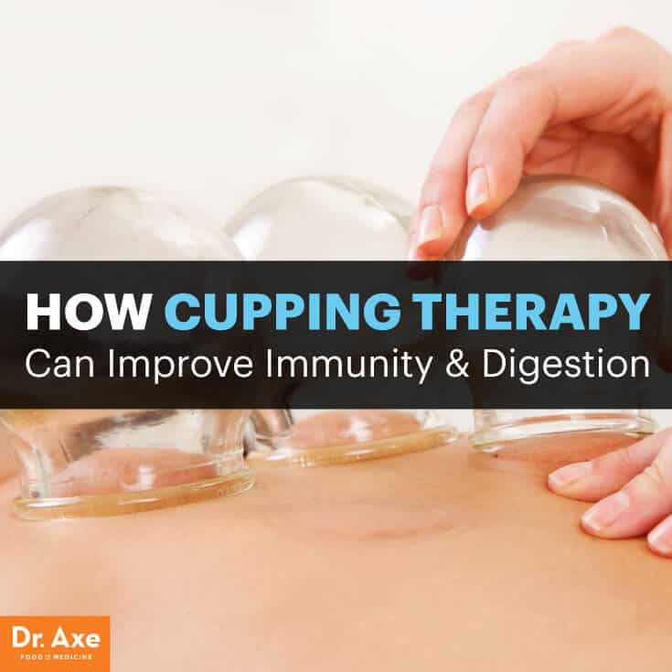 QI Esencial Loja Ecuador - Cupping Therapy