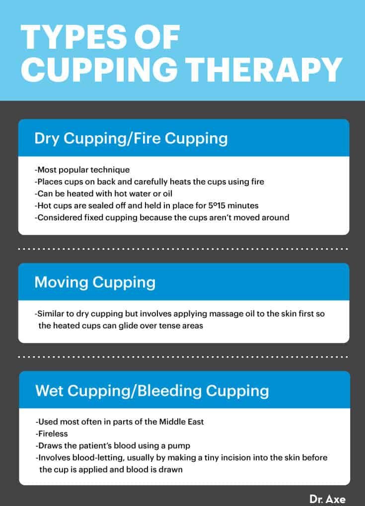 Types of cupping - Dr. Axe