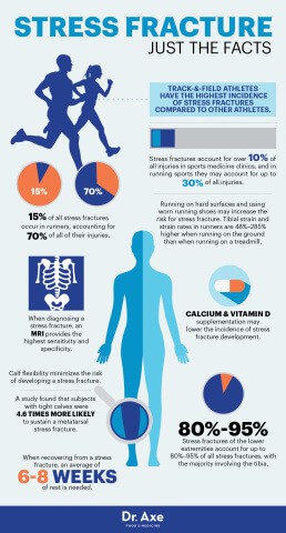 Stress Fracture Symptoms + How to Speed Up Recovery Naturally - Dr. Axe