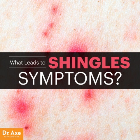 Shingles Symptoms, Common Risk Factors & Causes - Dr. Axe